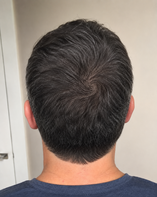 After